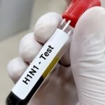 बरेली में स्वाइन फ्लू के दो और मरीज मिले, आंकड़ा 22 पार, संक्रमण के स्रोत का पता नहीं
