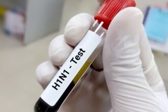 बरेली में स्वाइन फ्लू के दो और मरीज मिले, आंकड़ा 22 पार, संक्रमण के स्रोत का पता नहीं